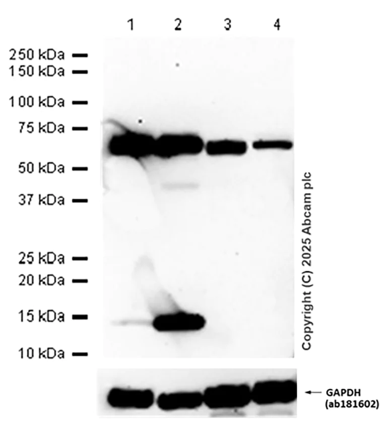Western blot - Anti-IGF2BP2/IMP-2 antibody [EPR6741(B)] - BSA and Azide free (AB246342)