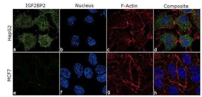 Immunocytochemistry/ Immunofluorescence - Anti-IGF2BP2/IMP-2 Antibody [RP23040258] (AB313421)