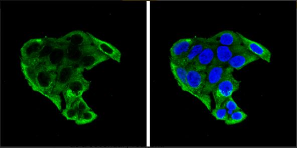 Immunocytochemistry/ Immunofluorescence - Anti-IGFBP1 antibody (AB228741)