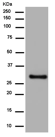 Western blot - Anti-IGFBP1 antibody [EPR14471(B)] (AB180948)