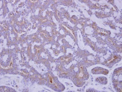 Immunohistochemistry (Formalin/PFA-fixed paraffin-embedded sections) - Anti-IGFBP2 antibody (AB227316)