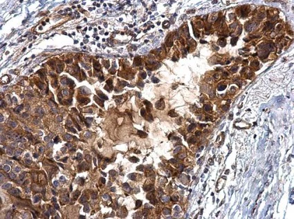 Immunohistochemistry (Formalin/PFA-fixed paraffin-embedded sections) - Anti-IGFBP2 antibody (AB227881)