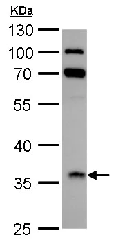 Western blot - Anti-IGFBP2 antibody (AB227881)