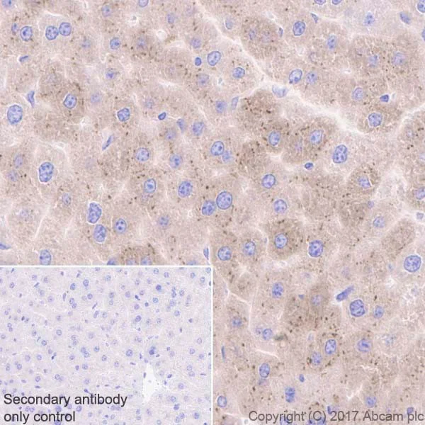 Immunohistochemistry (Formalin/PFA-fixed paraffin-embedded sections) - Anti-IGFBP2 antibody [EPR18012-257] (AB188200)