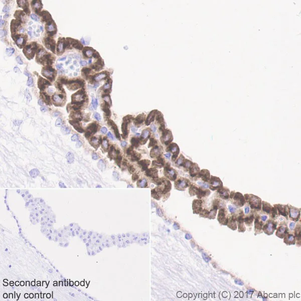 Immunohistochemistry (Formalin/PFA-fixed paraffin-embedded sections) - Anti-IGFBP2 antibody [EPR18012-257] (AB188200)