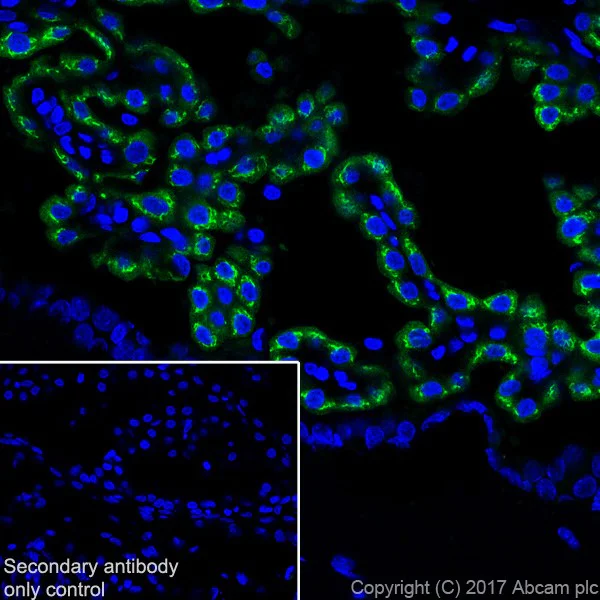 Immunohistochemistry (Frozen sections) - Anti-IGFBP2 antibody [EPR18012-257] (AB188200)