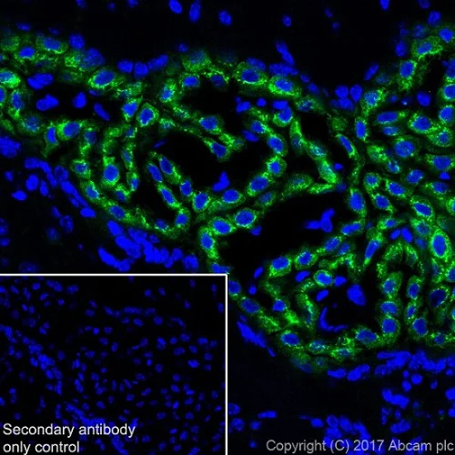 Immunohistochemistry (Frozen sections) - Anti-IGFBP2 antibody [EPR18012-257] (AB188200)