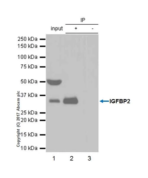 Immunoprecipitation - Anti-IGFBP2 antibody [EPR18012-257] (AB188200)