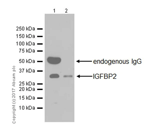 Western blot - Anti-IGFBP2 antibody [EPR18012-257] (AB188200)