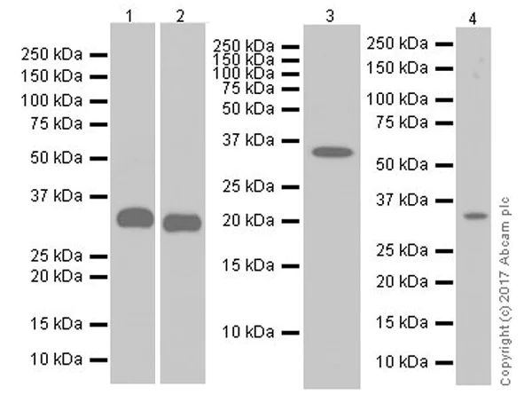 Western blot - Anti-IGFBP2 antibody [EPR18012-257] (AB188200)