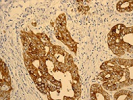 Immunohistochemistry (Formalin/PFA-fixed paraffin-embedded sections) - Anti-IGFBP2 antibody [EPR3380(2)] (AB109284), expandable thumbnail