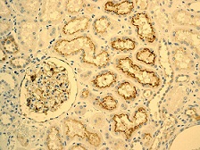 Immunohistochemistry (Formalin/PFA-fixed paraffin-embedded sections) - Anti-IGFBP2 antibody [EPR3380(2)] (AB109284), expandable thumbnail