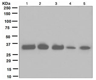 Western blot - Anti-IGFBP2 antibody [EPR3380(2)] (AB109284), expandable thumbnail