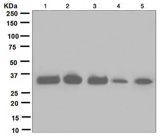 Western blot - Anti-IGFBP2 antibody [EPR3380(2)] (AB109284)