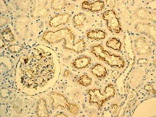 Immunohistochemistry (Formalin/PFA-fixed paraffin-embedded sections) - Anti-IGFBP2 antibody [EPR3380(2)] - BSA and Azide free (AB239965)
