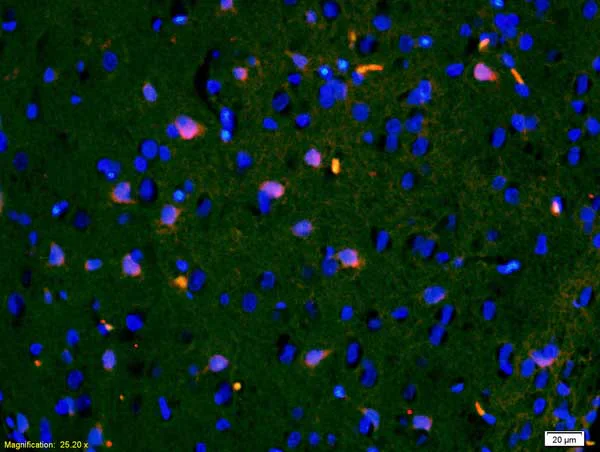 Immunohistochemistry (Formalin/PFA-fixed paraffin-embedded sections) - Anti-IGFBP3 antibody (AB217205)