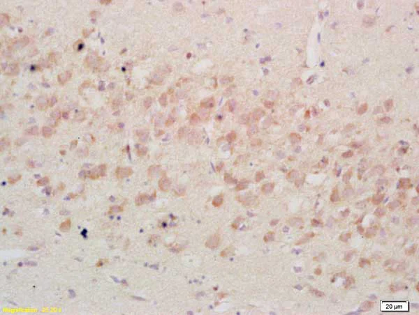 Immunohistochemistry (Formalin/PFA-fixed paraffin-embedded sections) - Anti-IGFBP3 antibody (AB217205)