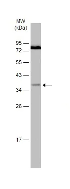 Western blot - Anti-IGFBP3 antibody (AB272857)