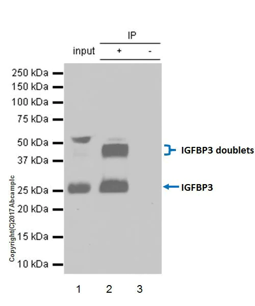 Immunoprecipitation - Anti-IGFBP3 antibody [EPR18680-153] - BSA and Azide free (AB224530)
