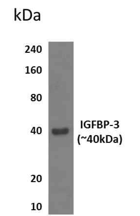Western blot - Anti-IGFBP3 antibody [RM0096-11B16] (AB86461)