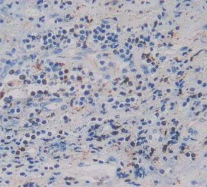 Immunohistochemistry (Formalin/PFA-fixed paraffin-embedded sections) - Anti-IGFBP4 antibody [A3] (AB239512)