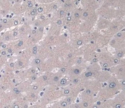 Immunohistochemistry (Formalin/PFA-fixed paraffin-embedded sections) - Anti-IGFBP4 antibody [A3] (AB239512)