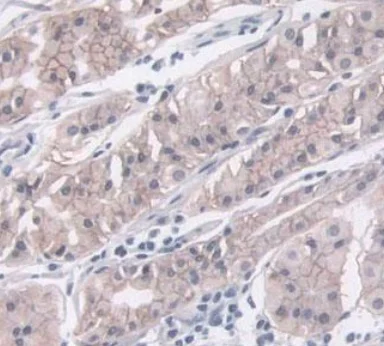 Immunohistochemistry (Formalin/PFA-fixed paraffin-embedded sections) - Anti-IGFBP4 antibody [A3] (AB239512)