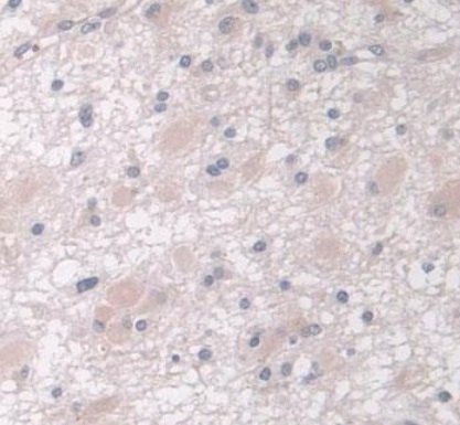 Immunohistochemistry (Formalin/PFA-fixed paraffin-embedded sections) - Anti-IGFBP4 antibody [A3] (AB239512)