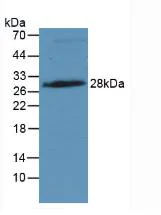 Western blot - Anti-IGFBP4 antibody [A3] (AB239512)