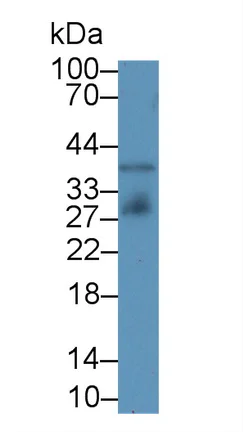 Western blot - Anti-IGFBP4 antibody [A3] (AB239512)