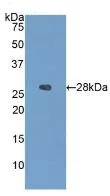 Western blot - Anti-IGFBP4 antibody [A3] (AB239512)