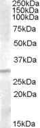 Western blot - Anti-IGFBP4 antibody (AB77350)