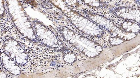Immunohistochemistry (Formalin/PFA-fixed paraffin-embedded sections) - Anti-IGFBP4 antibody [C15] (AB239594)