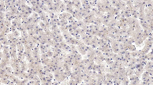 Immunohistochemistry (Formalin/PFA-fixed paraffin-embedded sections) - Anti-IGFBP4 antibody [C15] (AB239594)