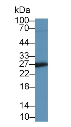 Western blot - Anti-IGFBP4 antibody [C15] (AB239594)