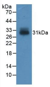 Western blot - Anti-IGFBP4 antibody [C15] (AB239594)