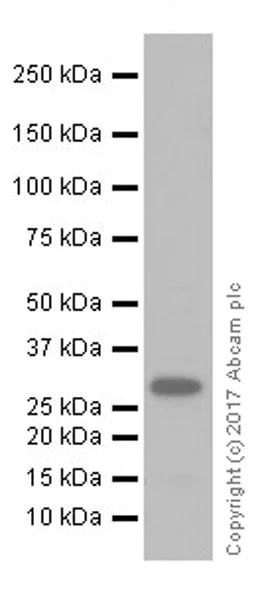 Western blot - Anti-IGFBP4 antibody [EPR19762] (AB205581)
