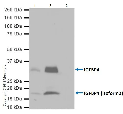 Immunoprecipitation - Anti-IGFBP4 antibody [EPR19762] - BSA and Azide free (AB251435)
