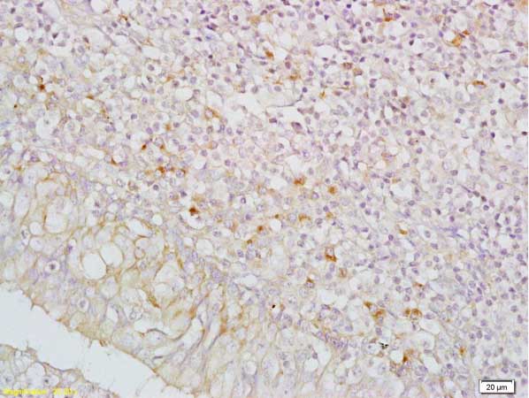 Immunohistochemistry (Formalin/PFA-fixed paraffin-embedded sections) - Anti-IGFBP5 antibody (AB216622)