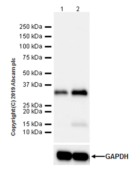 Western blot - Anti-IGFBP5 antibody [EPR18013-137] (AB254324)