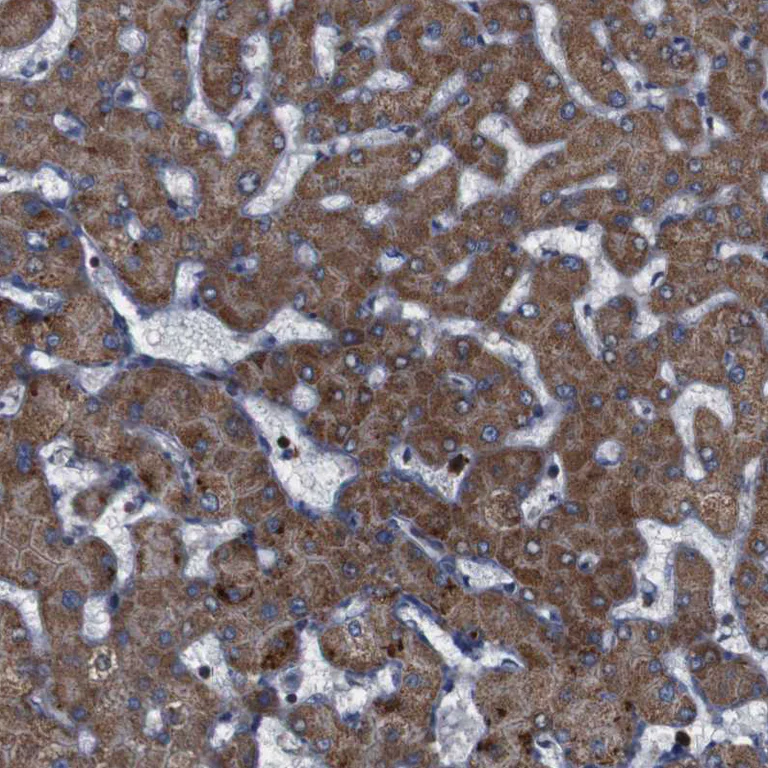 Immunohistochemistry (Formalin/PFA-fixed paraffin-embedded sections) - Anti-IGFBP6 antibody (AB262898)