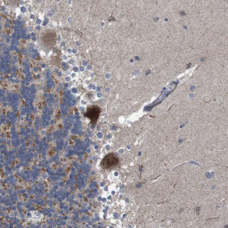 Immunohistochemistry (Formalin/PFA-fixed paraffin-embedded sections) - Anti-IGFBP6 antibody (AB262898)