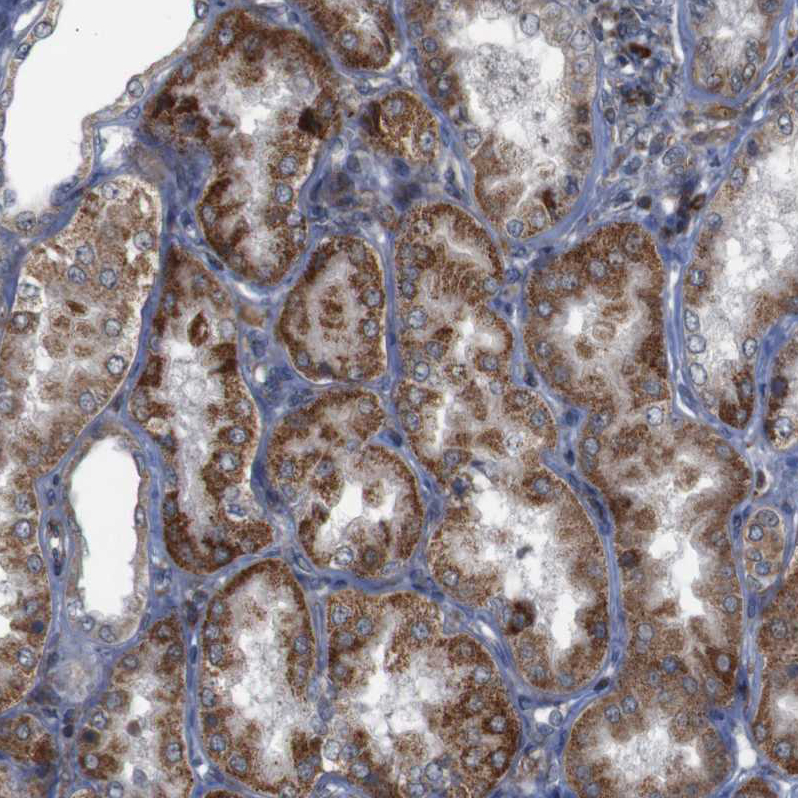 Immunohistochemistry (Formalin/PFA-fixed paraffin-embedded sections) - Anti-IGFBP6 antibody (AB262898)