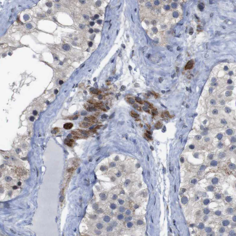 Immunohistochemistry (Formalin/PFA-fixed paraffin-embedded sections) - Anti-IGFBP6 antibody (AB262898)