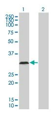Western blot - IGFBP6 overexpression 293T lysate (whole cell) (AB94189)