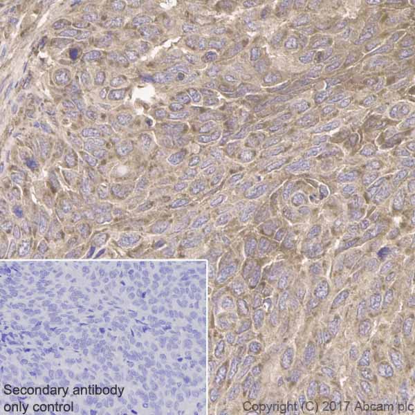 Immunohistochemistry (Formalin/PFA-fixed paraffin-embedded sections) - Anti-IGFBP7 antibody [EPR11912(B)] (AB171085)