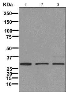 Western blot - Anti-IGFBP7 antibody [EPR11912(B)] (AB171085)