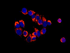 Immunocytochemistry/ Immunofluorescence - Anti-IGFBP7 antibody [EPR11912(B)] - BSA and Azide free (AB202765)