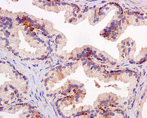 Immunohistochemistry (Formalin/PFA-fixed paraffin-embedded sections) - Anti-IGFBP7 antibody [EPR11912(B)] - BSA and Azide free (AB202765)