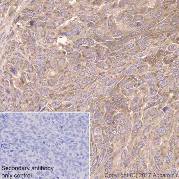 Immunohistochemistry (Formalin/PFA-fixed paraffin-embedded sections) - Anti-IGFBP7 antibody [EPR11912(B)] - BSA and Azide free (AB202765)
